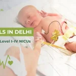 Newborn receiving NICU care with monitoring equipment, representing NICU levels in Delhi and advanced neonatal support at Sapling Hospital.